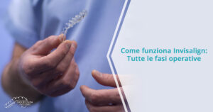 Come funziona Invisalign: tutte le fasi operative